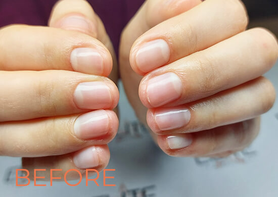Before, French manicure, Elite nails, salon, Budapest, District 1.